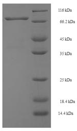 SDS-PAGE