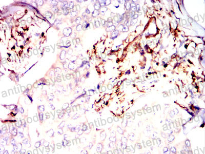 Валидация AntibodySystem RHD71003 (1749)