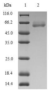 SDS-PAGE