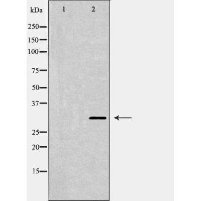 Валидация Affinity DF6022 - 17244