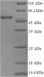 SDS-PAGE