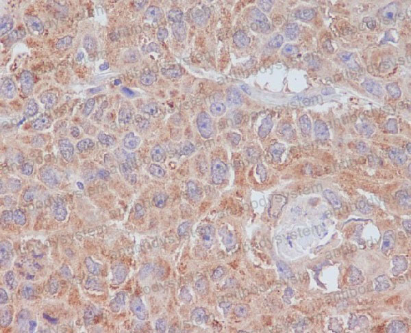 Валидация AntibodySystem RHN60801