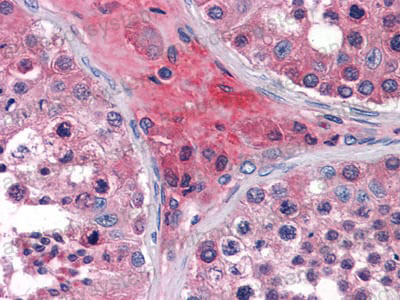 Валидация AntibodySystem RHN91301