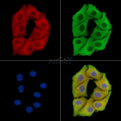 Валидация Affinity DF15355 - 11659