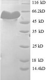 SDS-PAGE