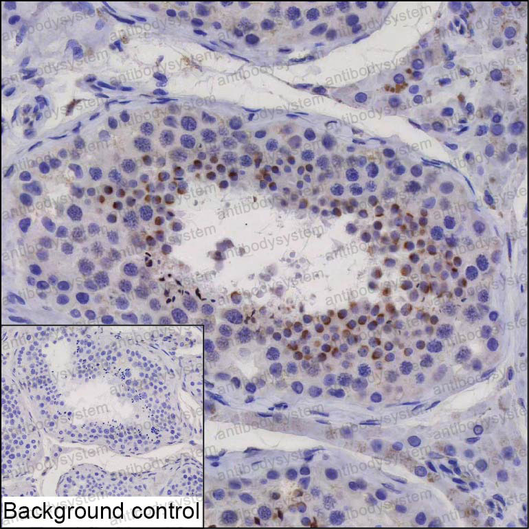 Валидация AntibodySystem RHP10901