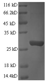 SDS-PAGE