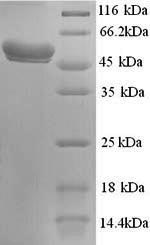 SDS-PAGE