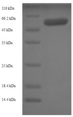 SDS-PAGE