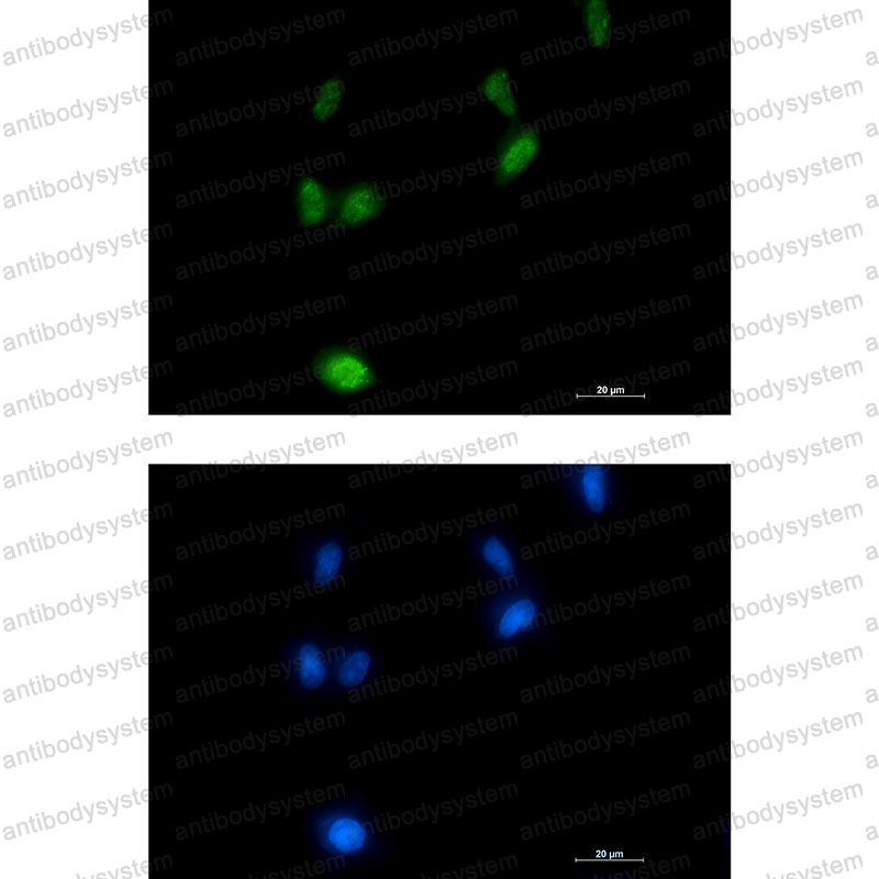 Валидация IF - AntibodySystem RHC12513