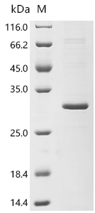 SDS-PAGE