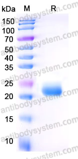 AHE54301, SDS-PAGE