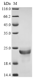 SDS-PAGE