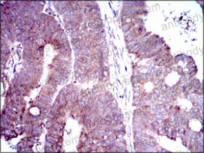 Валидация AntibodySystem RHJ65303