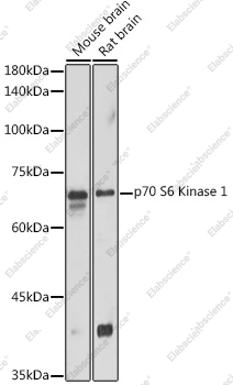 Вестерн-блоттинг, p70 S6 Kinase 1, различные клеточные линии