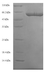 SDS-PAGE