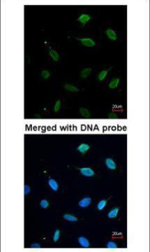 Валидация AssayVector ARM1245(638)