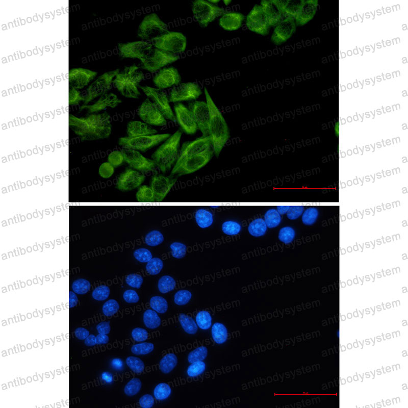 Валидация IF - AntibodySystem RHC36101