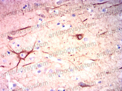 Валидация AntibodySystem RHC23301 (800)