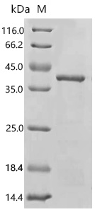 SDS-PAGE