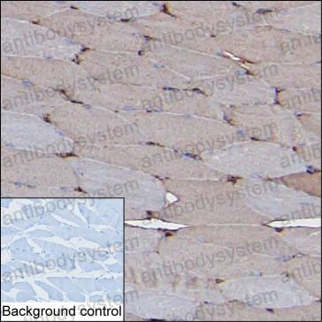 Валидация AntibodySystem RHC93304