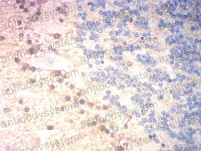 Валидация AntibodySystem RHC08403 (603)