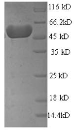 SDS-PAGE
