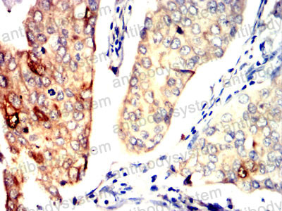 Валидация AntibodySystem RHG17701