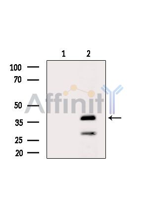 Валидация Affinity DF13860 - 9575