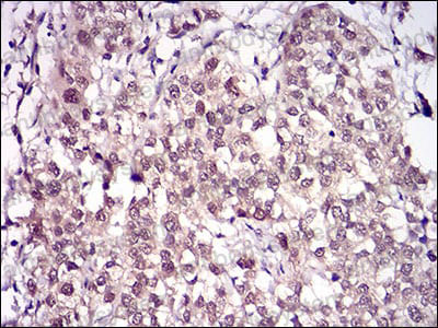 Валидация AntibodySystem RHK91801 (3744)