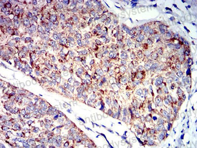 Валидация AntibodySystem RHE53101 (2215)