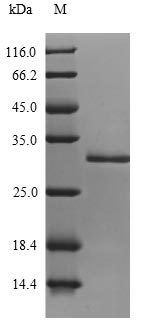 SDS-PAGE
