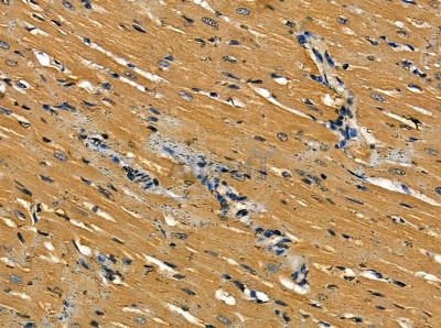 Валидация Affinity DF14093 - 9884