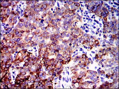 Валидация AntibodySystem RHH05001 (3147)