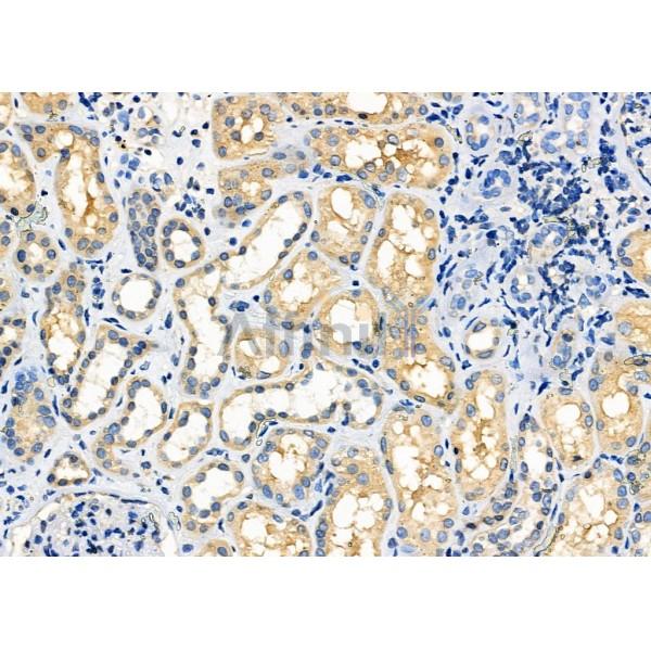 Валидация Affinity DF10303 - 5920