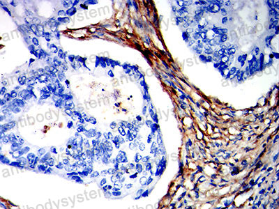 Валидация AntibodySystem RHH81904 (3312)