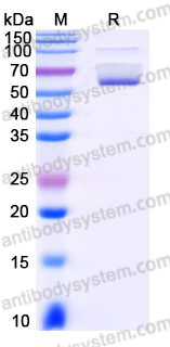 EHH21801, SDS-PAGE