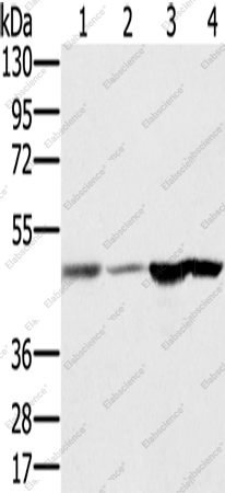Вестерн-блоттинг, RNH1, ткань мозга плода человека, ткань печени, ткань почки человека и клетки HepG2