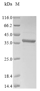 SDS-PAGE