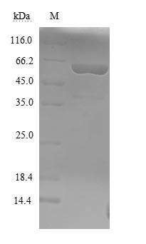SDS-PAGE