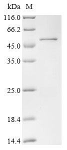 SDS-PAGE