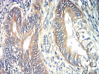 Валидация AntibodySystem RHD95601