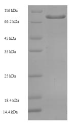SDS-PAGE