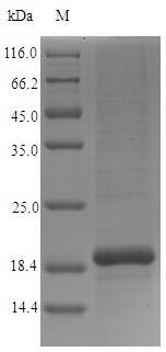 SDS-PAGE