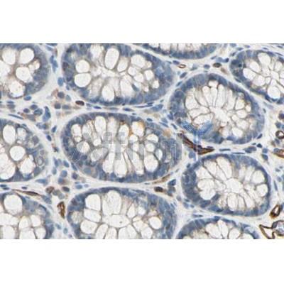 Валидация Affinity DF8338 - 20189