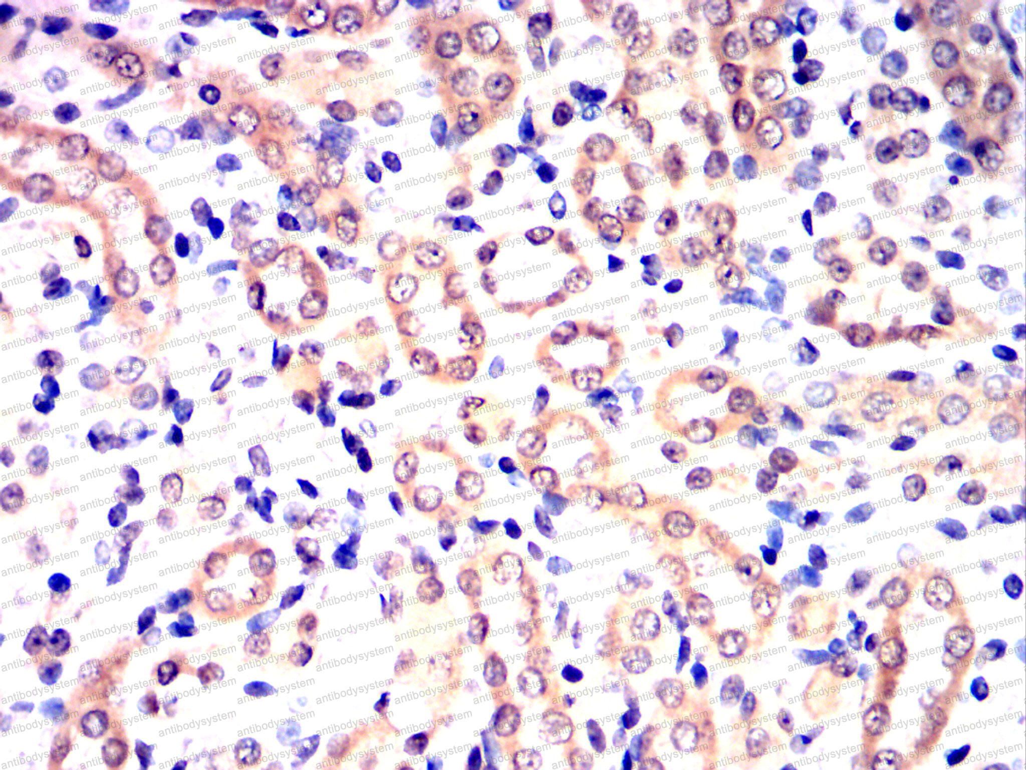 Валидация AntibodySystem RHE78702 (2325)