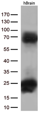 Валидация AssayVector ARM1939(2760)