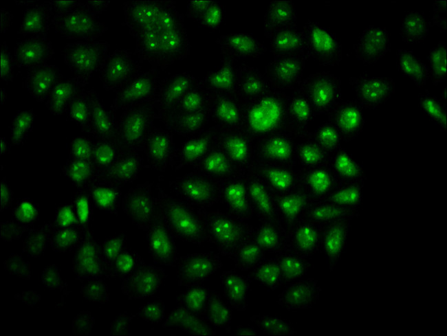 Валидация AssayVector ARM2017(2999)