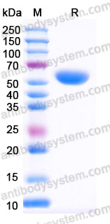 YHD57102, SDS-PAGE