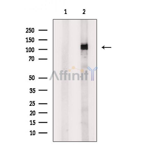 Валидация Affinity DF6987 - 18623